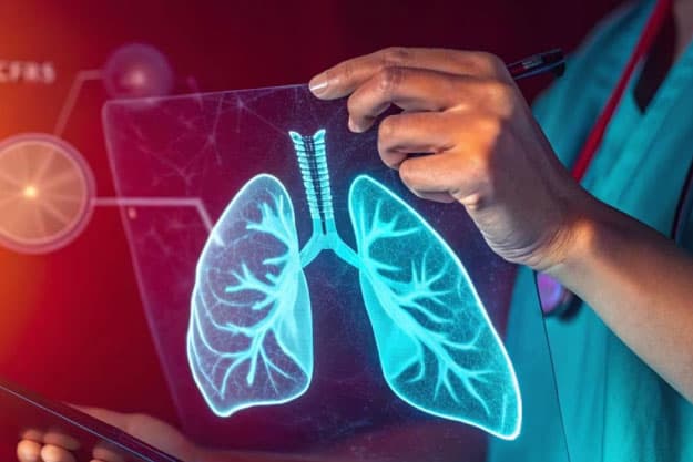 Embolia pulmonar: cuando una señal silenciosa puede poner tu vida en riesgo Embolia pulmonar: cuando una señal silenciosa puede poner tu vida en riesgo