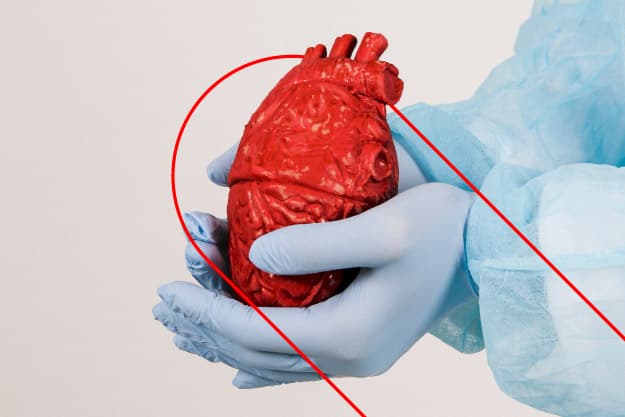 Cirugía cardiovascular mínimamente invasiva Cirugía cardiovascular mínimamente invasiva