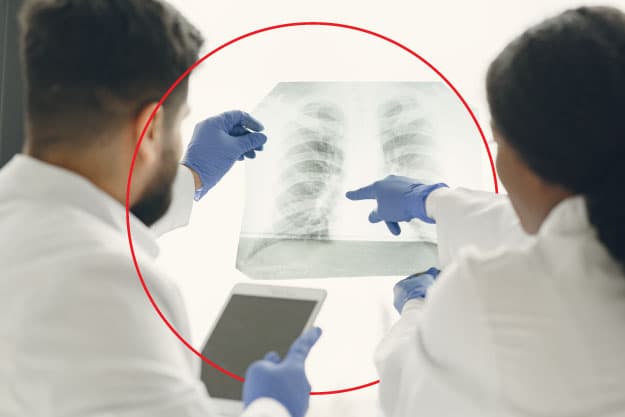 Médicos de hipertensión pulmonar en Colombia Médicos de hipertensión pulmonar en Colombia