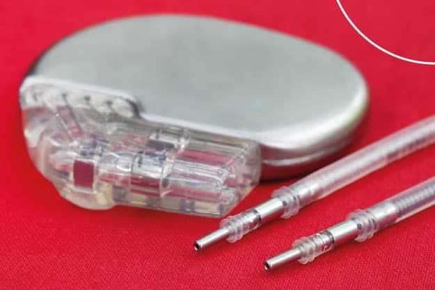 Blog Vital: ¿Cómo es vivir con un marcapaso?