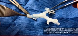 impresion-3d-medicina para-que-sirve-la-impresion-3d-en-la-medicina-bogota-colombia